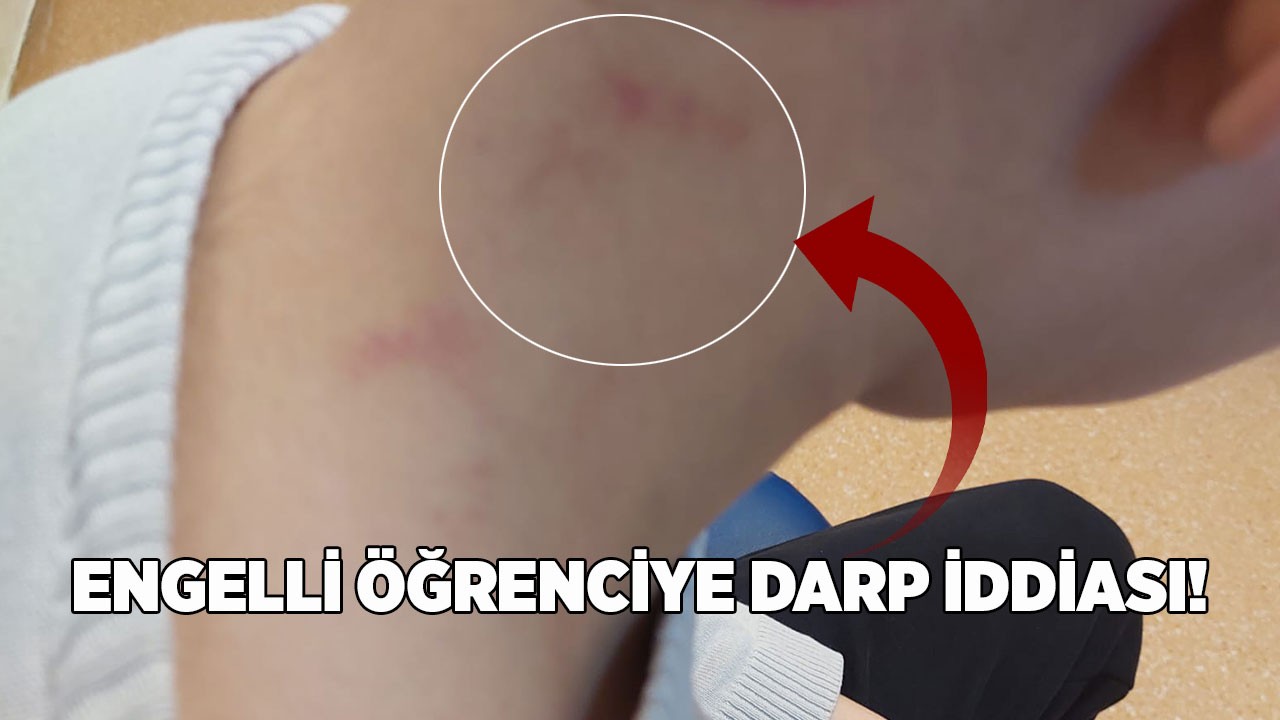 Ankara Mamak'ta engelli öğrenciye darp iddiası