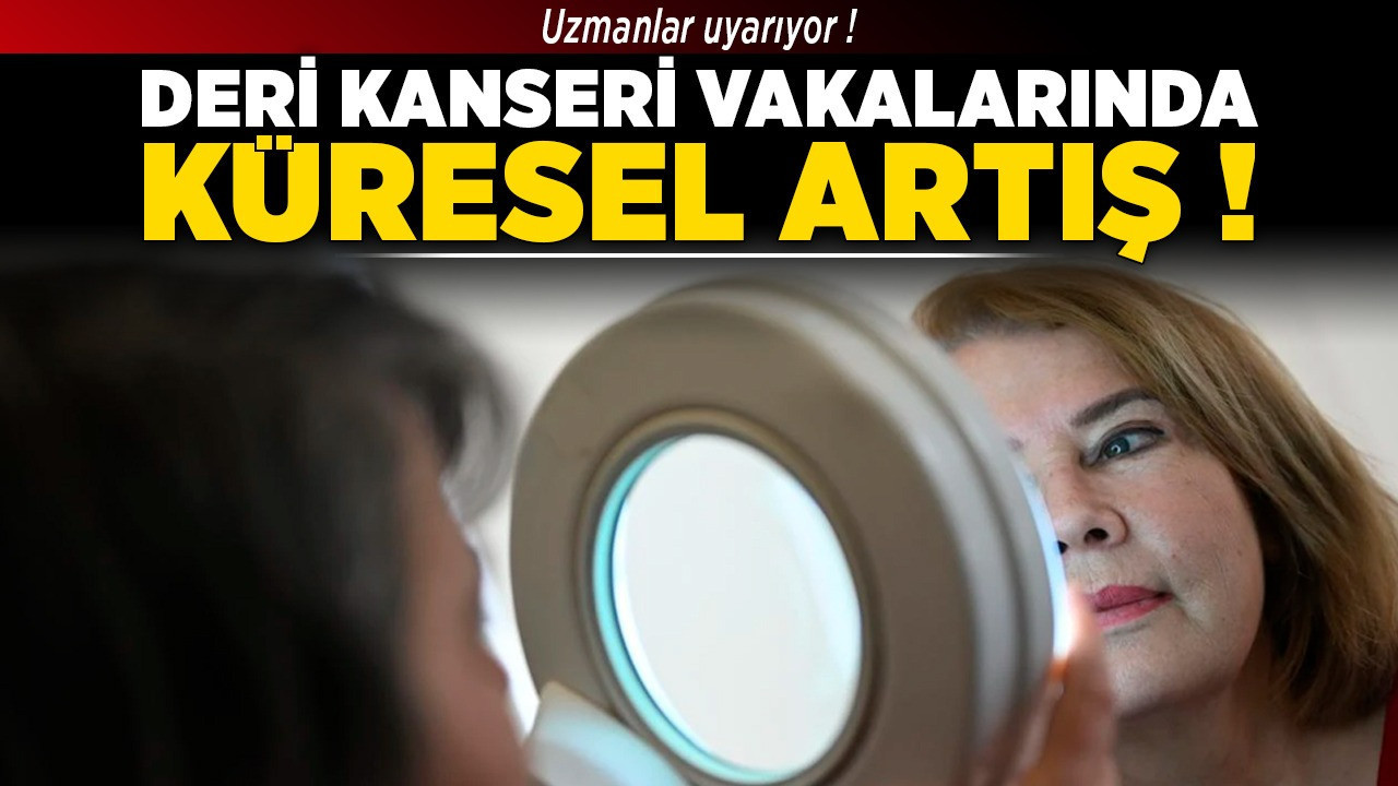 Deri kanseri vakalarında küresel artış!
