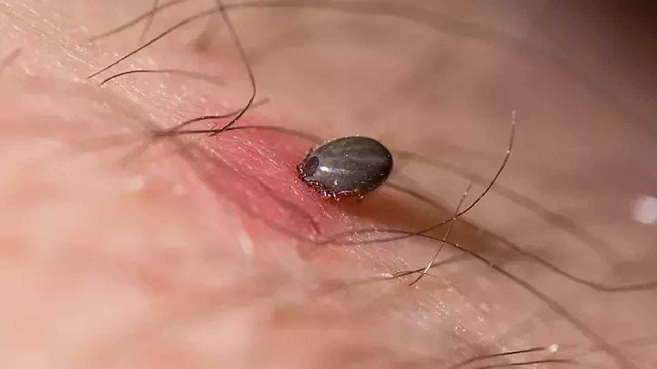 Mamak Belediyesi, Kene ve Haşere İhbar Hattı'nı kullanıma açtı