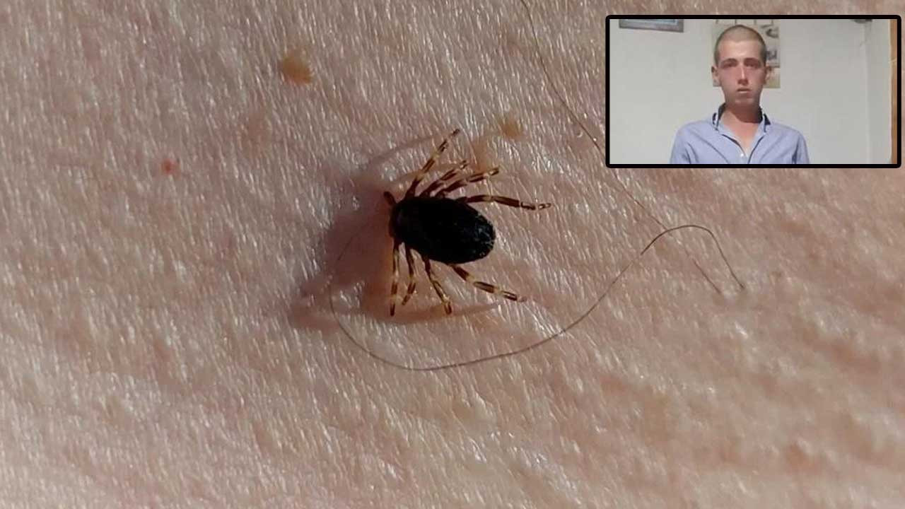 Ankara’da kene can aldı! Çubuk’ta kene ısıran 24 yaşındaki genç vefat etti