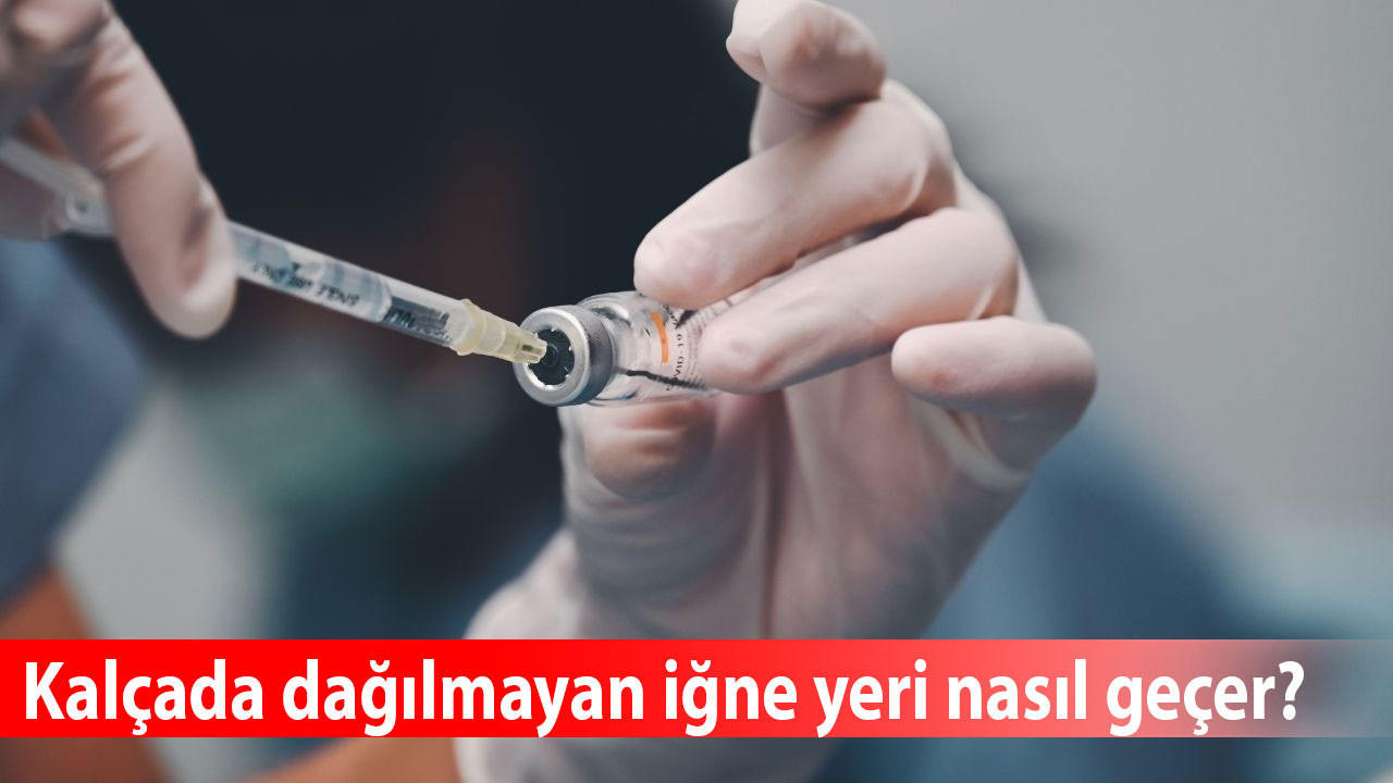 Kalçada dağılmayan iğne yeri nasıl geçer? Kalçadaki iğne şişlikleri neden olur, hangi doktora gidilir?