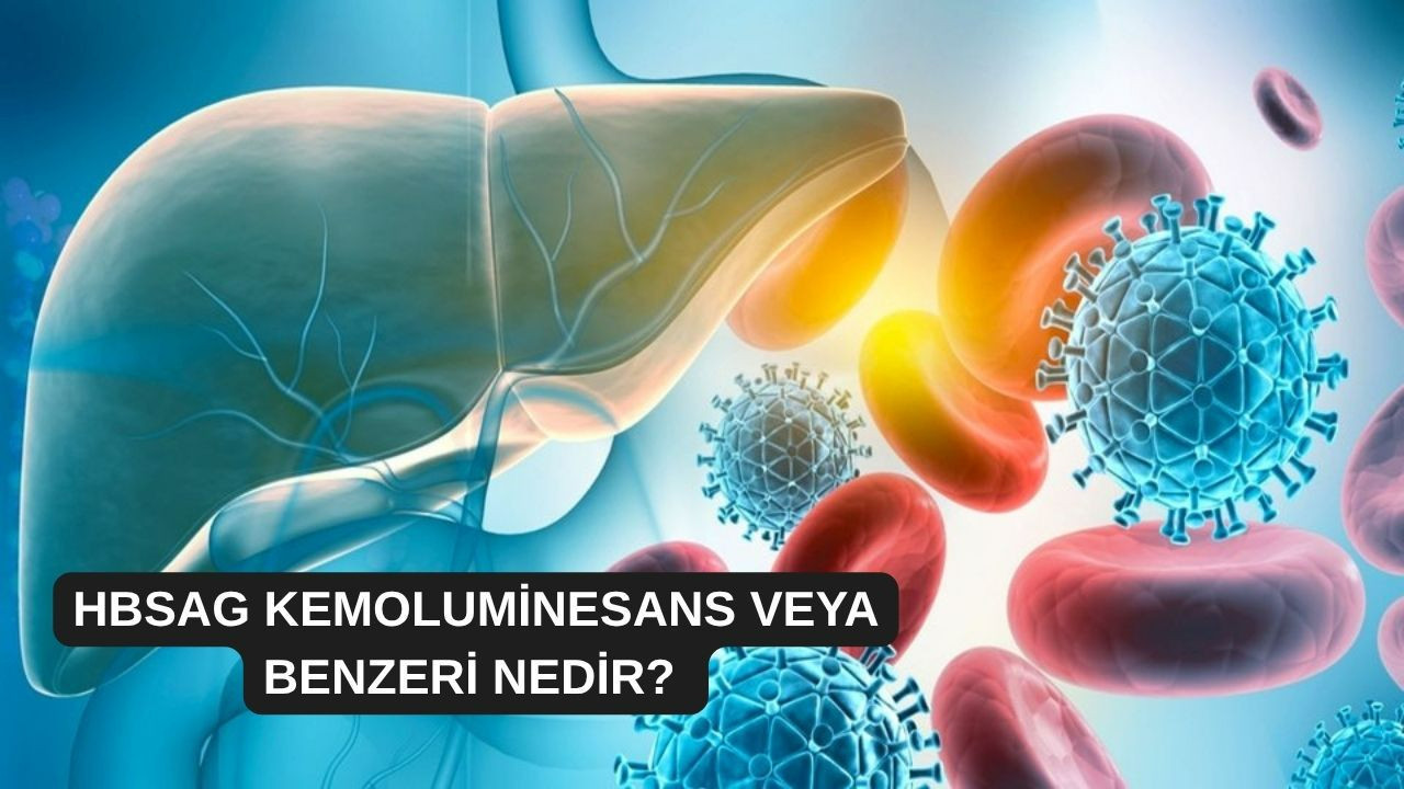 Hbsag Kemoluminesans veya benzeri nedir?