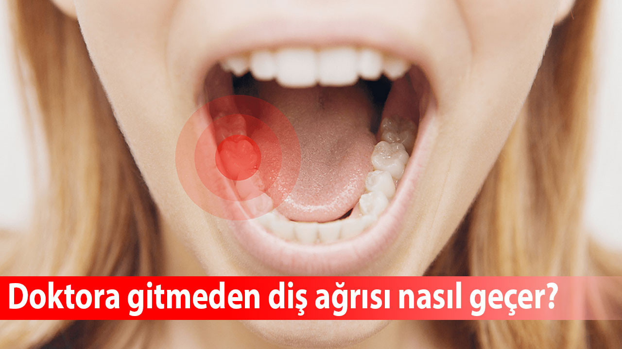 Diş ağrısına evde müdahale: Doktora gitmeden diş ağrısı nasıl geçer? Diş ağrısını en hızlı ne keser?