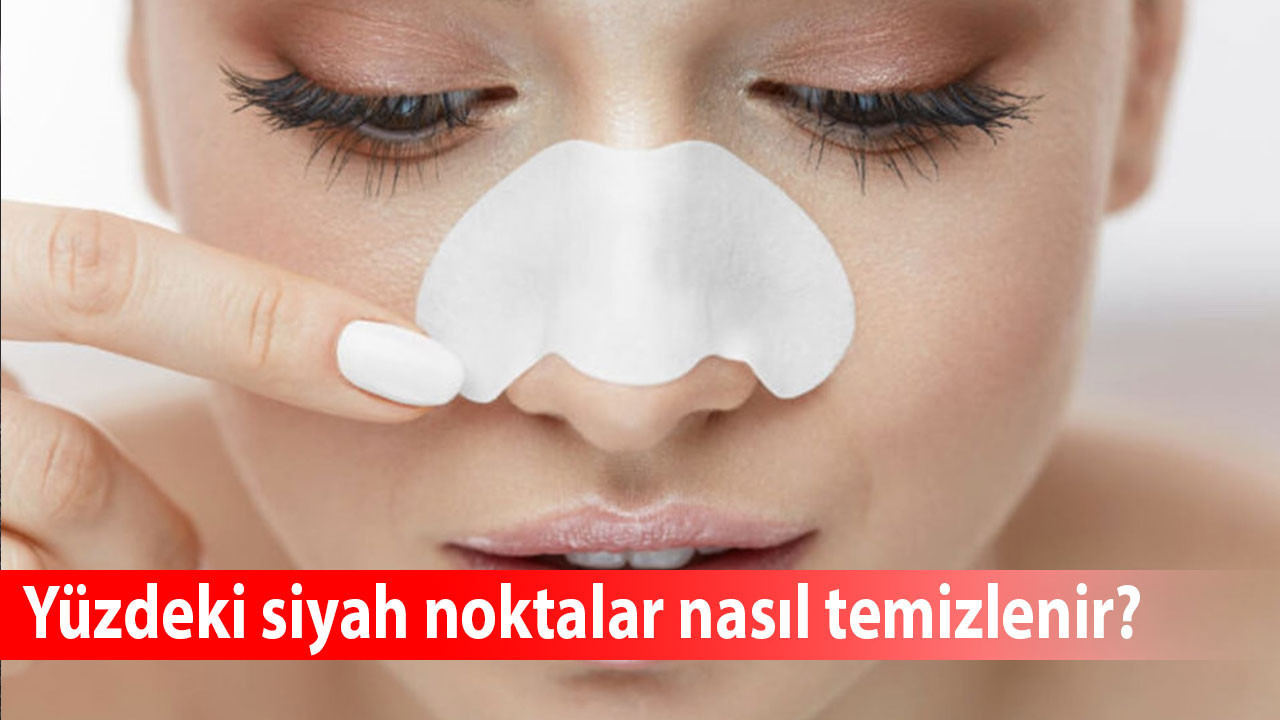 Yüzdeki siyah noktalar evde nasıl temizlenir, tamamen geçer mi?