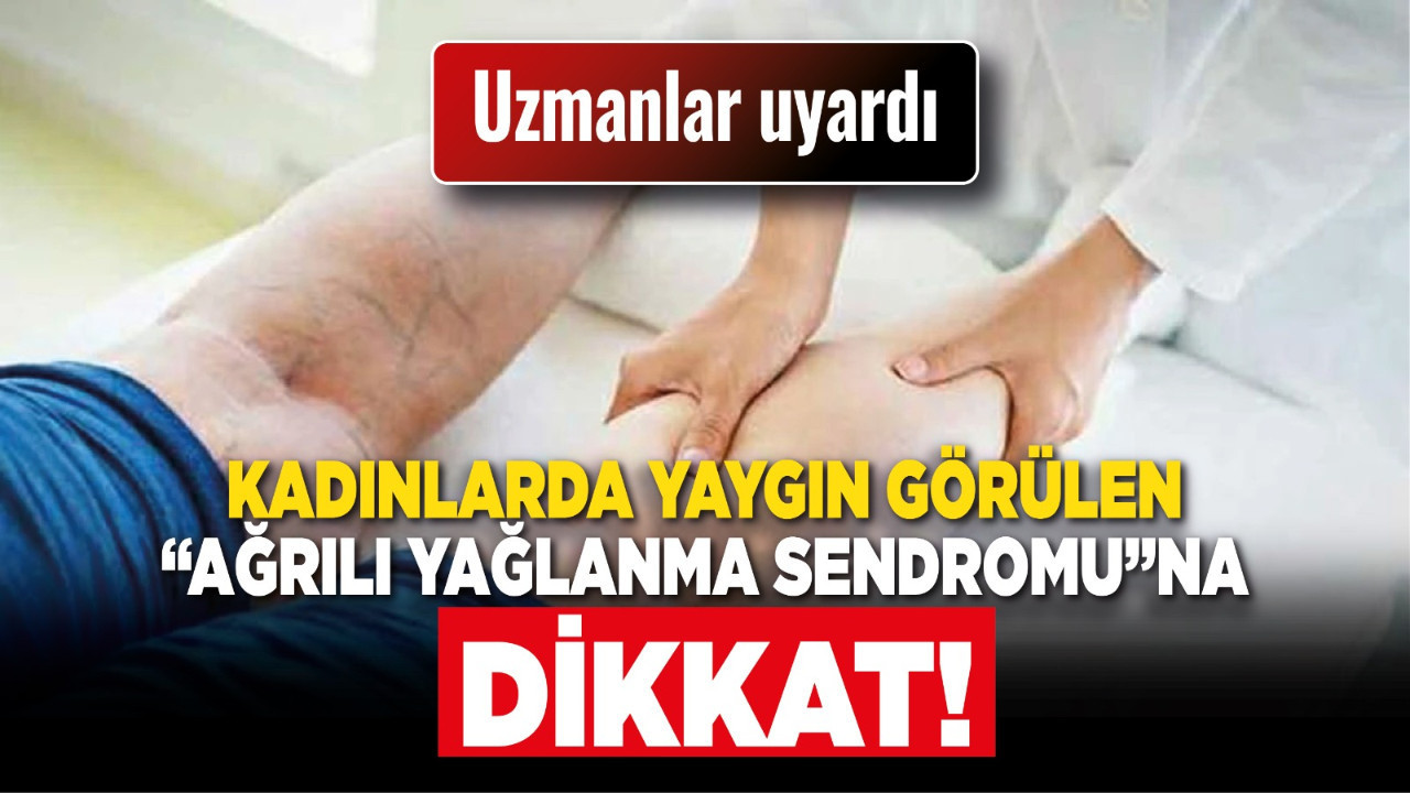 Uzmanlar uyardı: Kadınlarda yaygın görülen “ağrılı yağlanma sendromu”na dikkat!