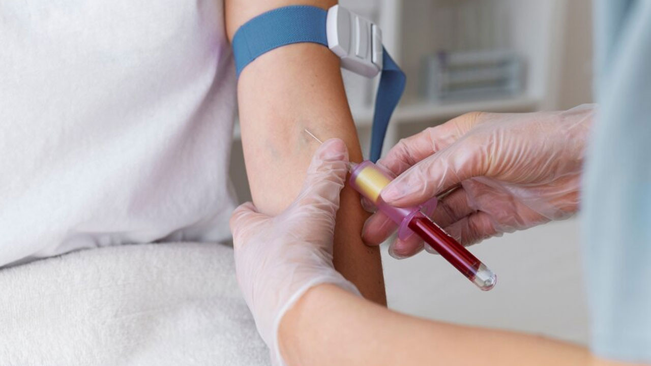Glukoz serum plazma yüksekliği nedir, kaç olursa tehlikeli, nasıl düşürülür, belirtileri nelerdir?