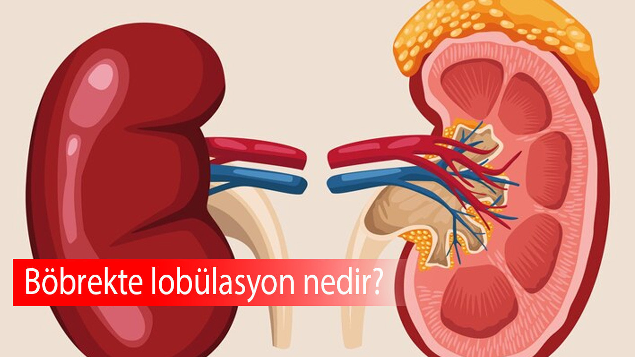 Böbrekte lobülasyon nedir?
