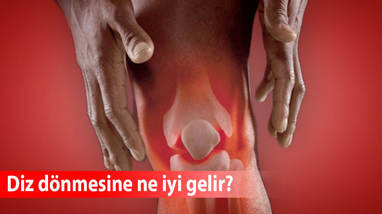 Diz dönmesine ne iyi gelir?