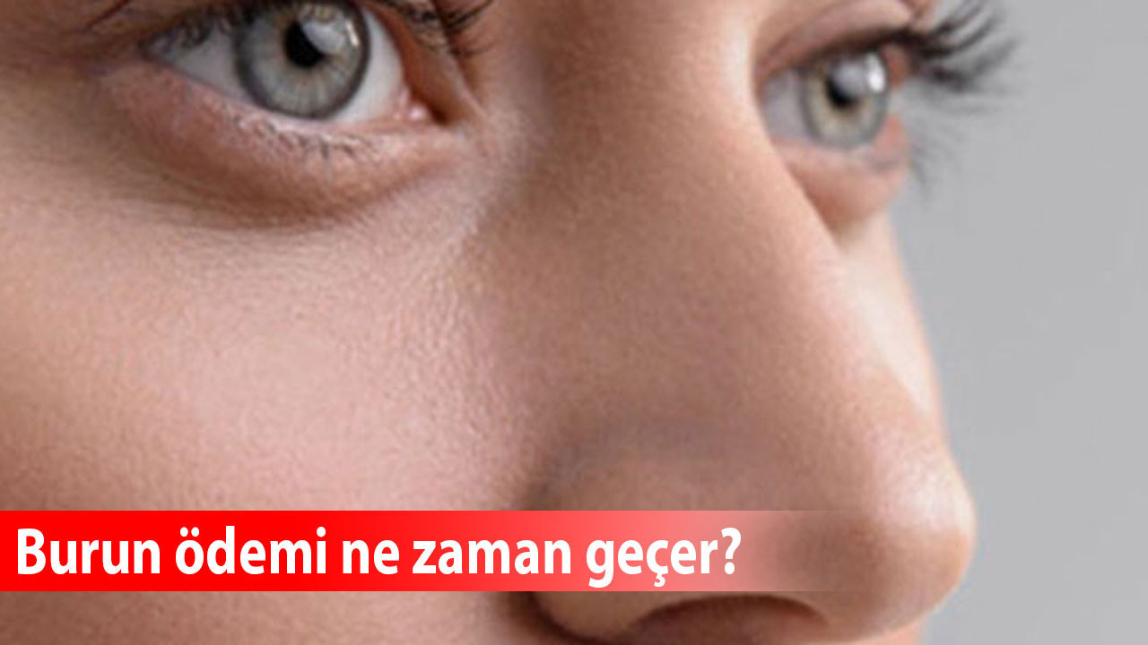 Burun ödemi ne zaman geçer?