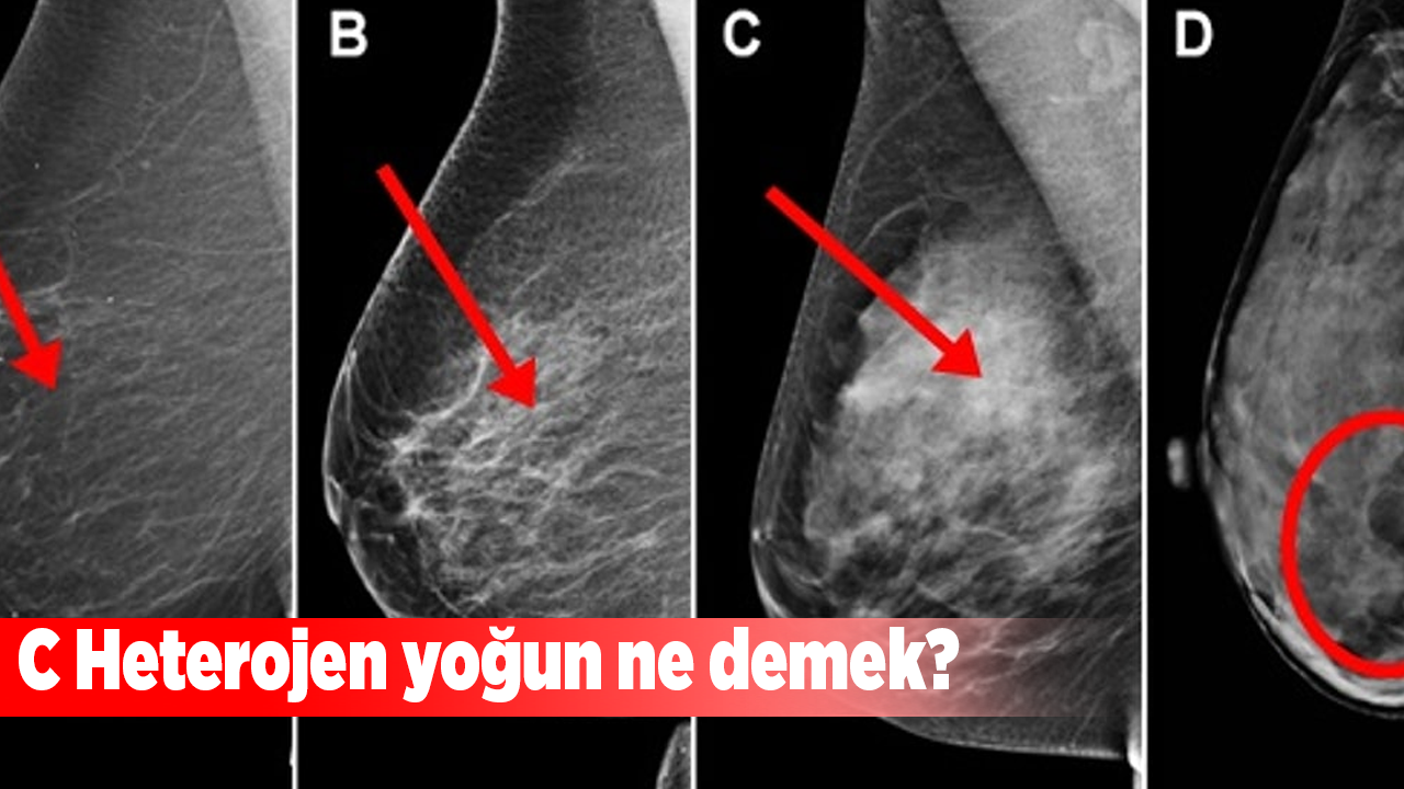 C Heterojen yoğun ne demek?