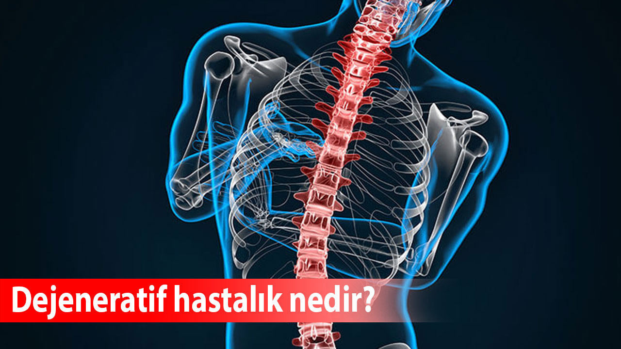 Dejeneratif hastalık nedir?