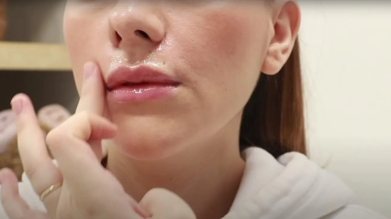 Vücut gelişiminde tüylenme neden olur?