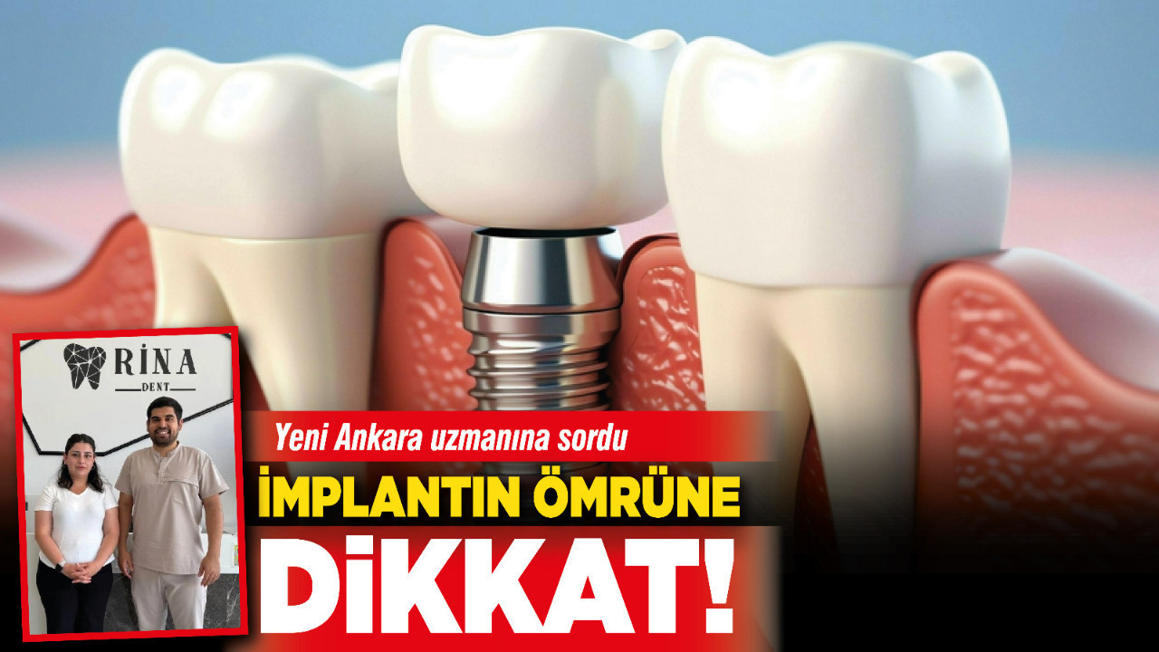 İmplantın ömrüne dikkat! Yeni Ankara uzmanına sordu!