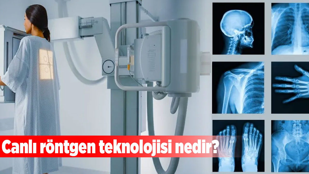 Canlı röntgen teknolojisi nedir?