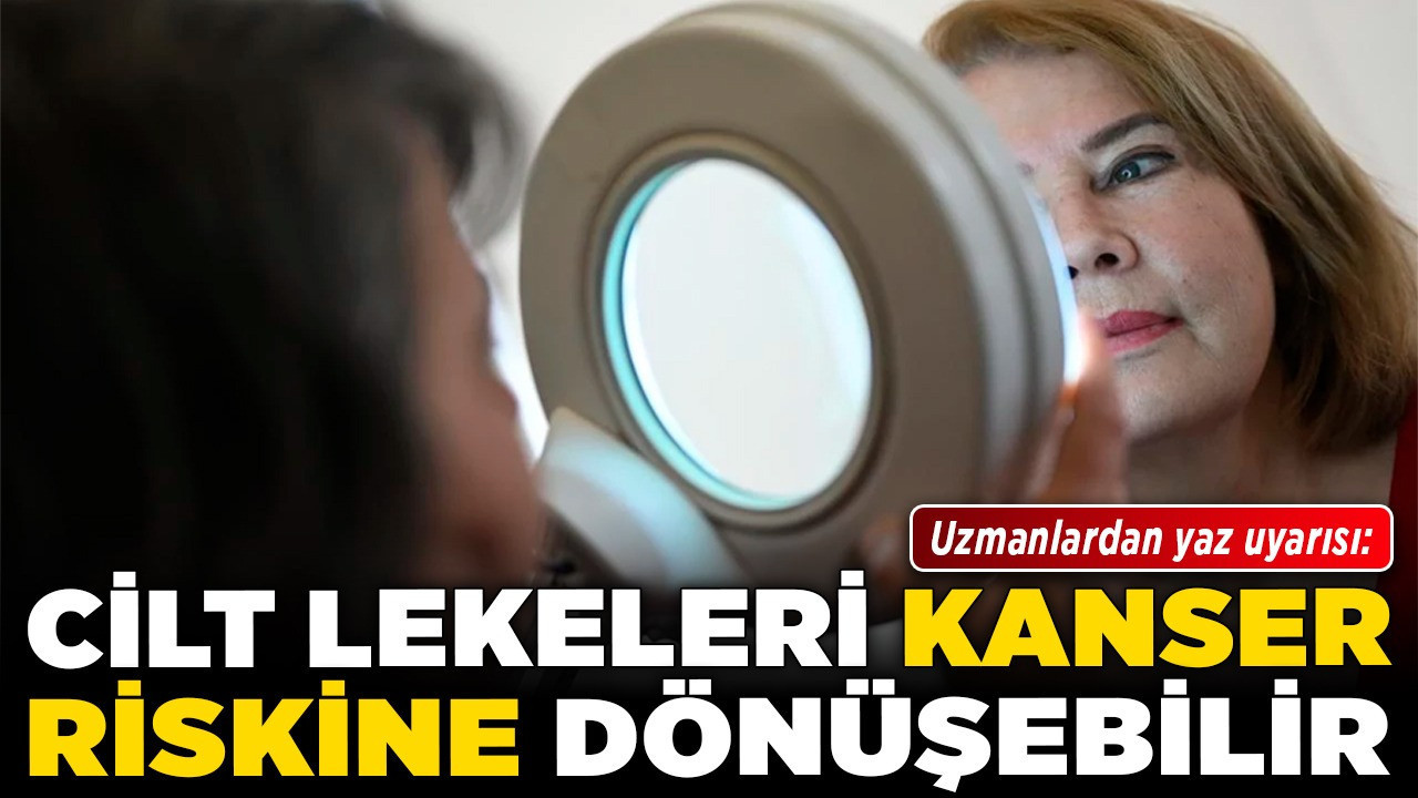 Uzmanlardan yaz uyarısı: Cilt lekeleri kanser riskine dönüşebilir!