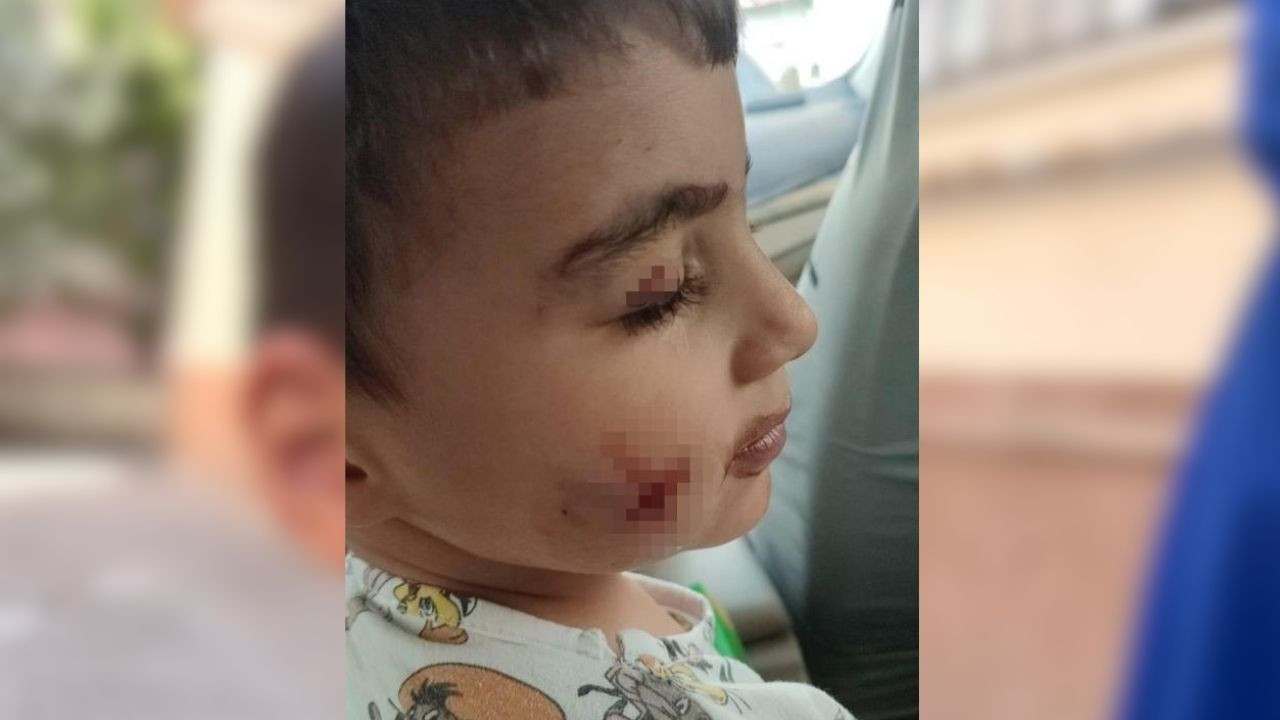 Sincan’da korkutan olay! Çocuğunu lağım faresi ısıran anneden belediyeye sitem