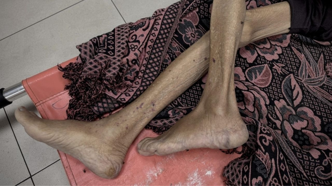 Kıtlığın kol gezdiği Gazze'de son 24 saatte bilanço iyice ağırlaştı