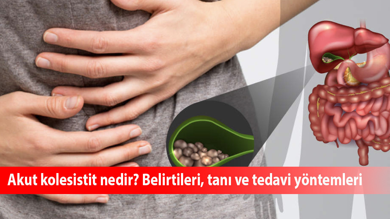 Akut kolesistit nedir? Belirtileri, tanı ve tedavi yöntemleri