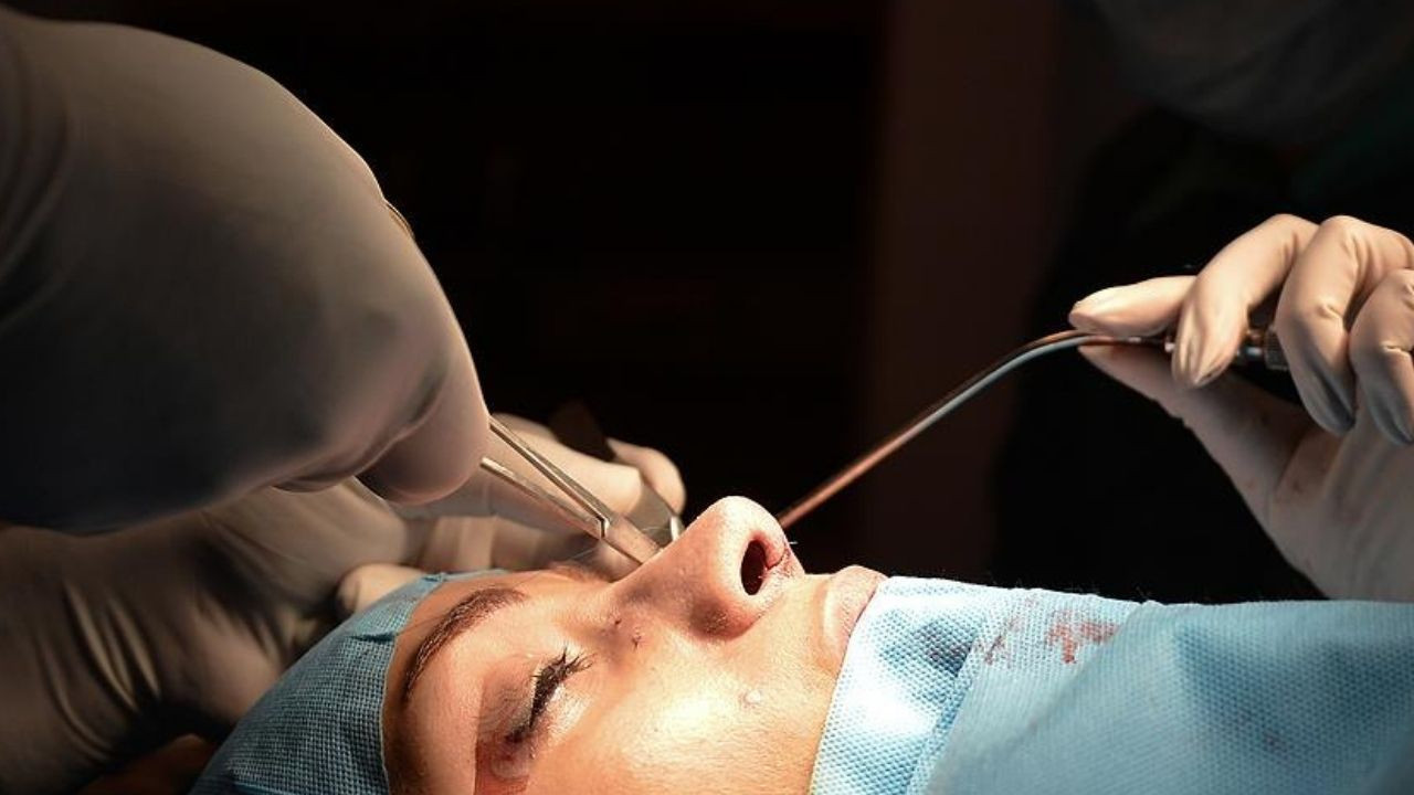 Burun törpüleme nedir? Ameliyat sonrası iyileşme sürecinde neler yapılmalı?