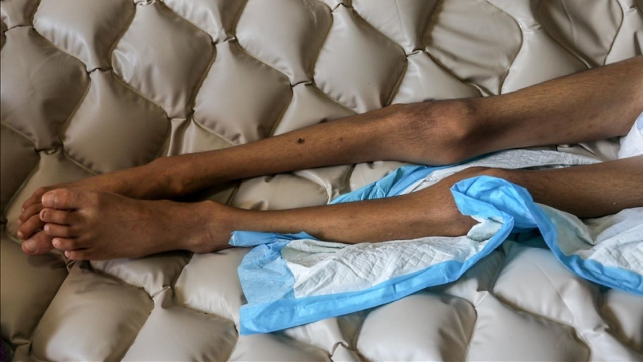 İsrail'in kıtlığı dayattığı Filistin'de, son bir günde bilanço ağırlaştı