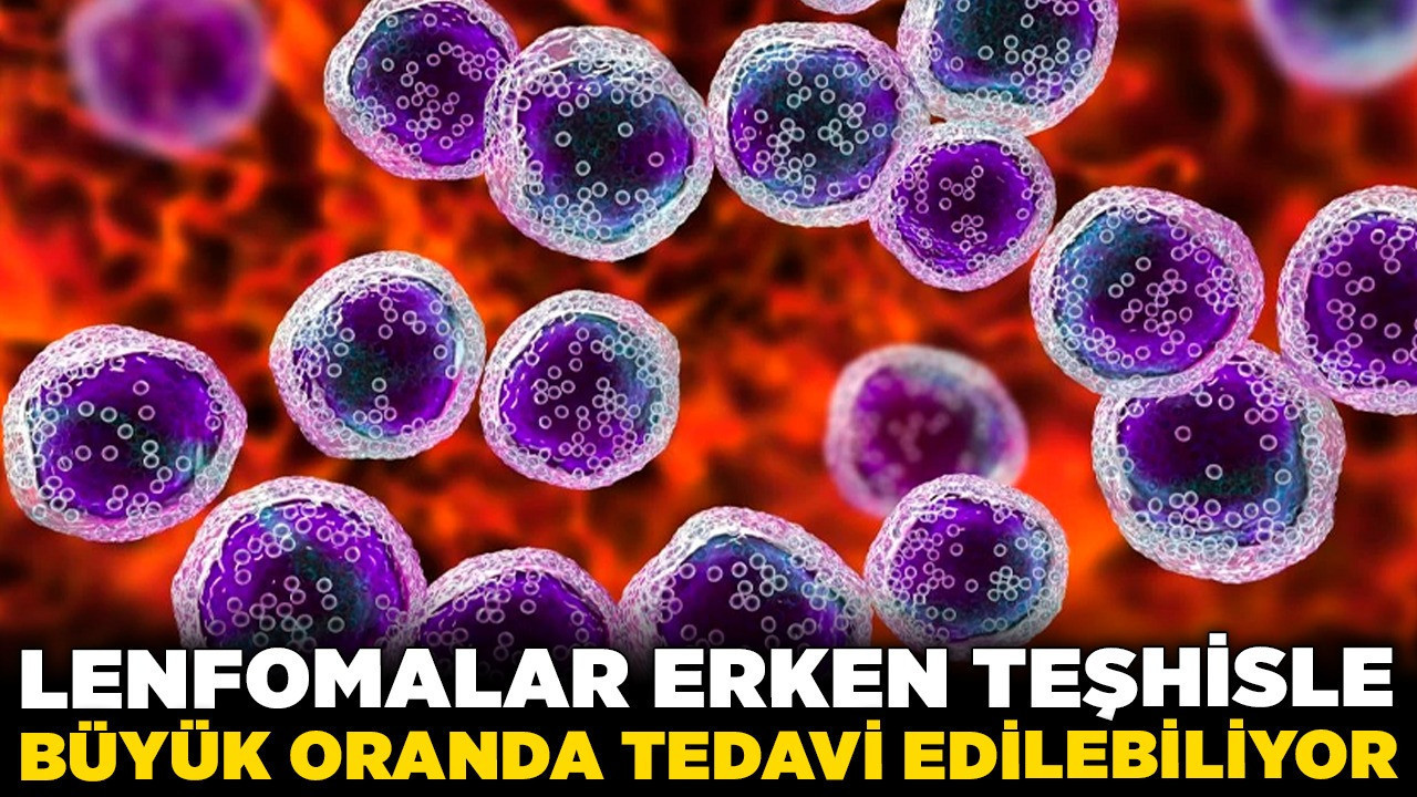 Uzmanlar uyardı: Lenfomalar erken teşhisle büyük oranda tedavi edilebiliyor