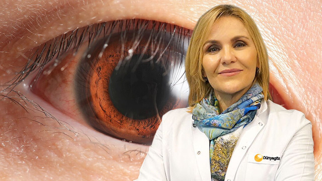 Göz sağlığında sinsi tehlike: "Kader değil, geç kalınmış bir ihmal"