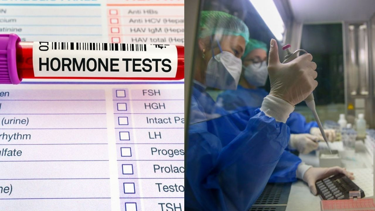 Hormon testleri ne kadar sürede çıkar, testin amacı nedir?