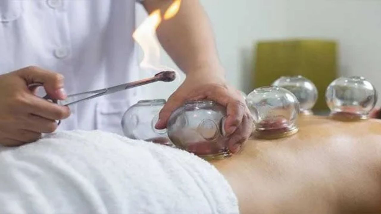 Hacamat yaptıktan sonra neler yenmez?