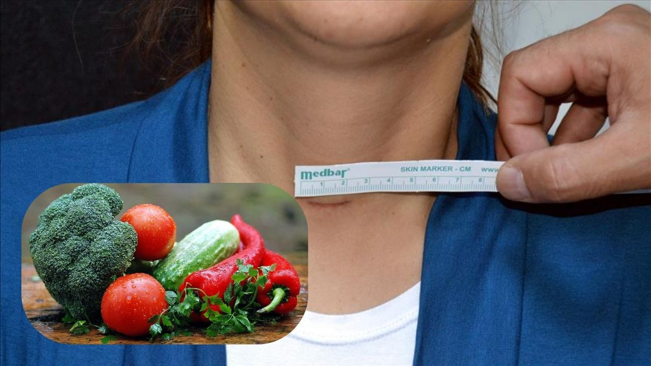 Guatrı tetikleyen ve rahatlatan besinler: Ne yemeli, ne yememeli?