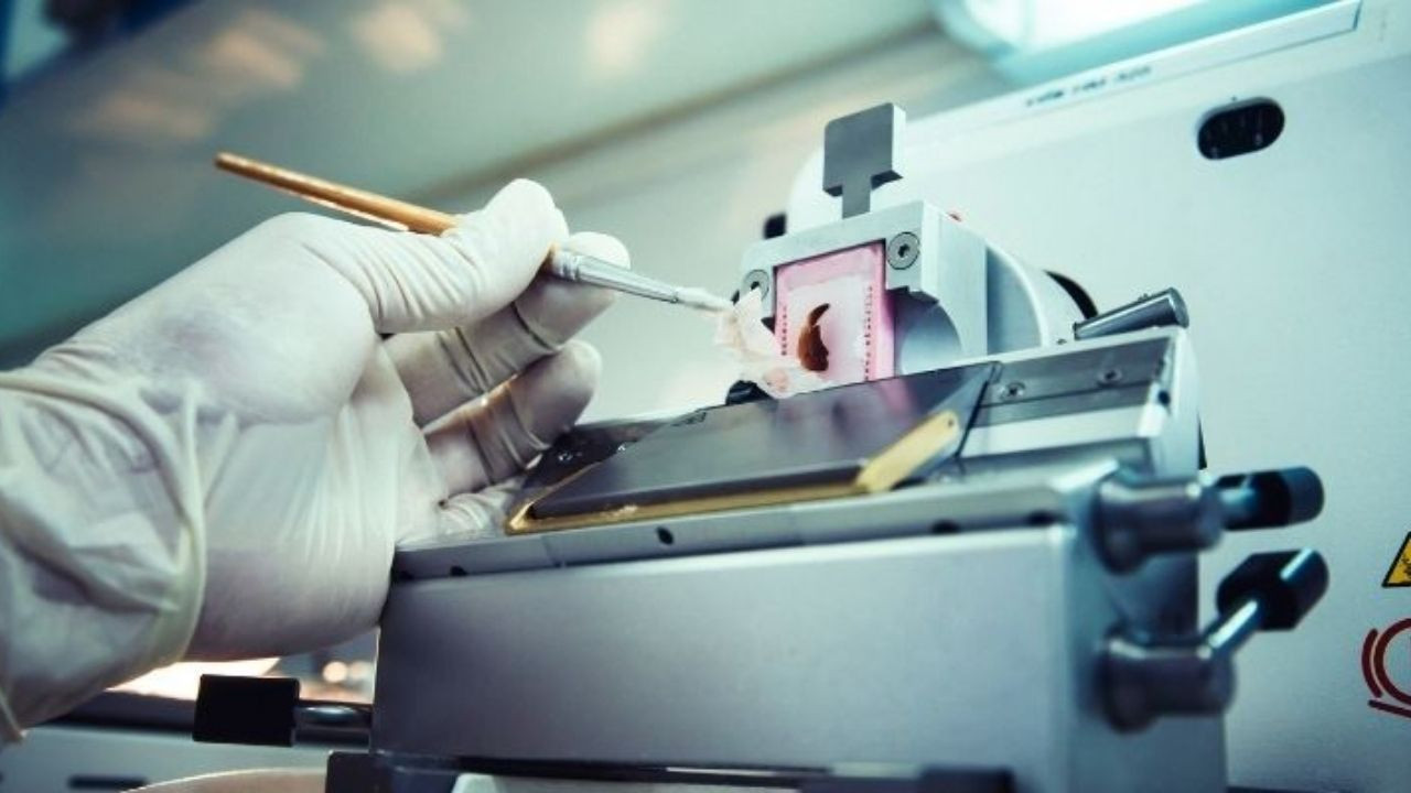 Karaciğer Biyopsisi nedir, nasıl yapılır?