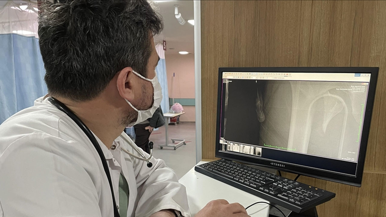 Uzmanlar uyardı: 5 yıl içinde 1,35 milyon osteoporoza bağlı kırık meydana gelecek!