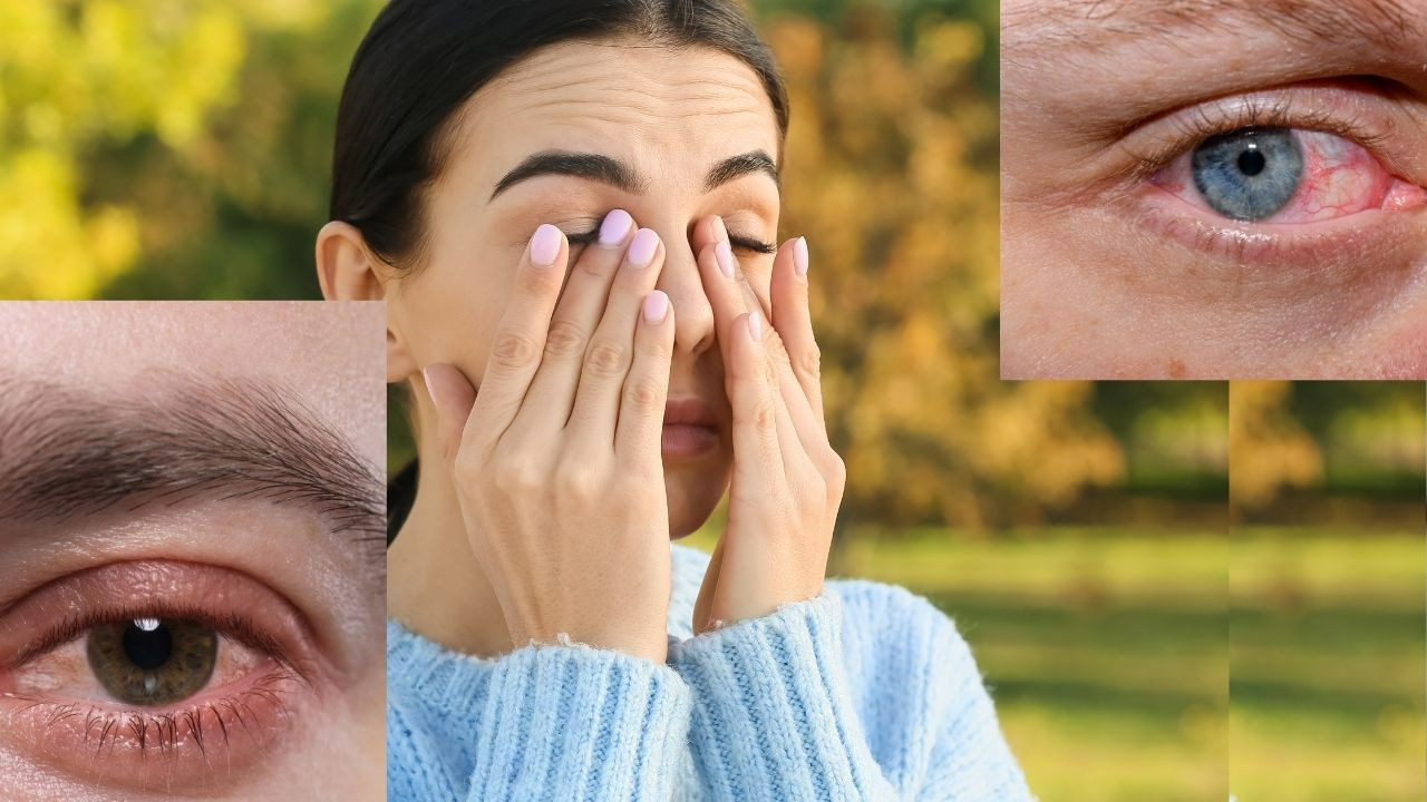 Ankara’da göz kuruluğu ve kaşıntı artıyor: İşte nedeni