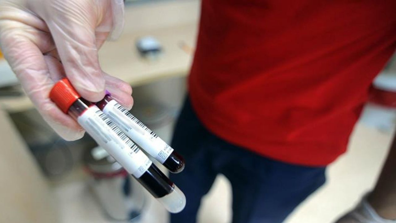 Kan tahlilinde LYM nedir? Yüksekliği ve düşüklüğü ne anlama gelir?