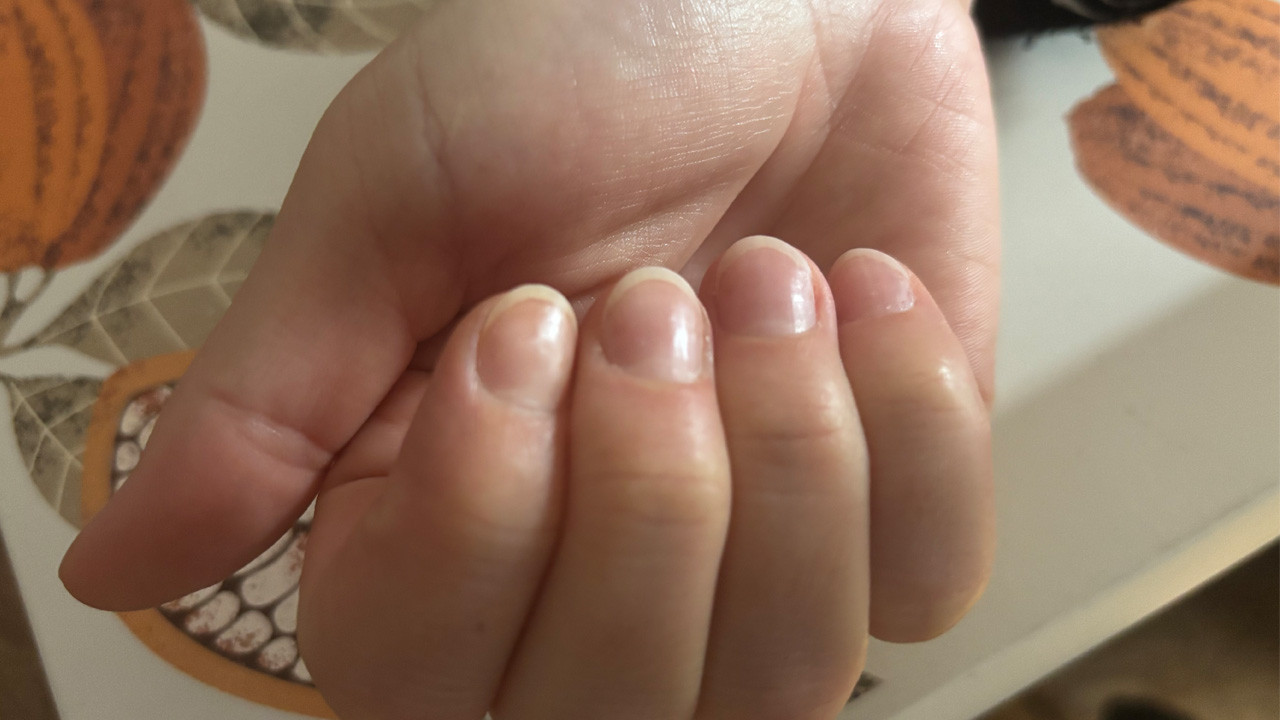 Tırnak rengine bak, hastalığını öğren