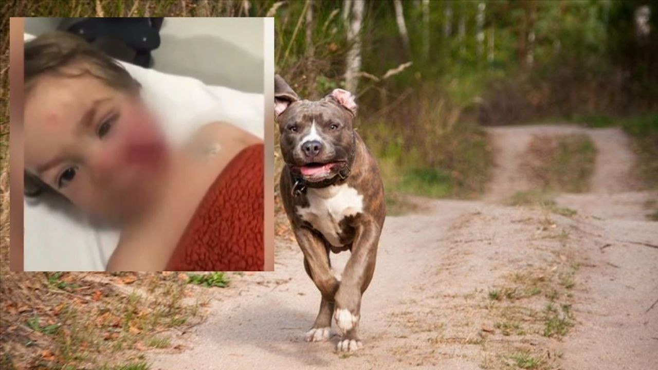 Etimesgut’taki pitbull saldırısında şok ihmal iddiası: 12 şikayete rağmen görevliler neden işlem yapmadı?