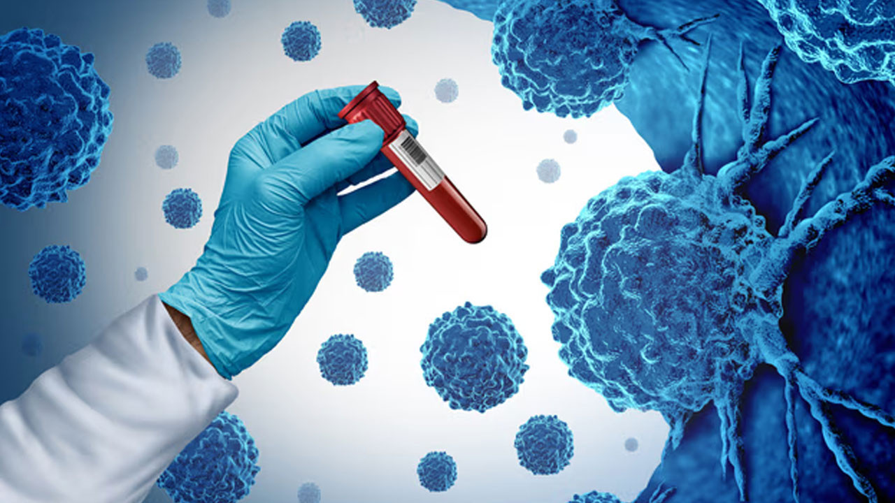 TÜİK verileri şaşırttı! Ankara kanserden kaynaklanan ölümlerde ilk sıralarda