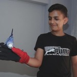 Bilkent Şehir Hastanesi, Filistinli 12 yaşındaki Ameer’e umut oldu