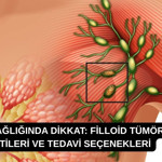 Meme sağlığında dikkat: Filloid tümör belirtileri ve tedavi seçenekleri