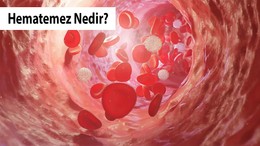 Hematemez Nedir?