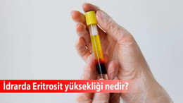 İdrarda Eritrosit yüksekliği nedir, ne anlama gelir, tedavisi?