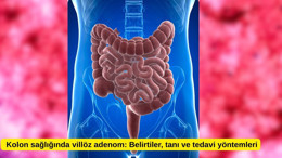 Kolon sağlığında villöz adenom: Belirtiler, tanı ve tedavi yöntemleri