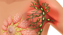 Meme kanserinde hayat kurtaran detay!