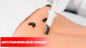 Adetliyken neden sülük yapılmaz?