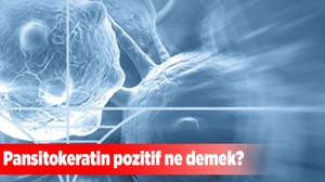 Pansitokeratin pozitif ne demek?