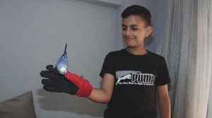 Bilkent Şehir Hastanesi, Filistinli 12 yaşındaki Ameer’e umut oldu