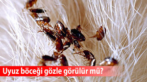 Uyuz böceği gözle görülür mü, nasıl ölür?