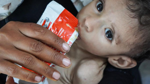 DSÖ: Gazze kentindeki sağlık tesislerinin sürekli tahrip edilmesi daha fazla ölüme yol açacak