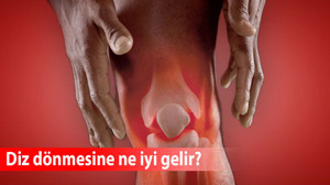 Diz dönmesine ne iyi gelir?