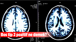 Bos tip 2 pozitif ne demek?