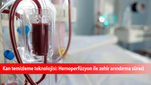 Kan temizleme teknolojisi: Hemoperfüzyon ile zehir arındırma süreci